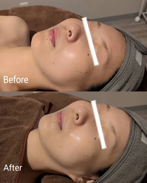 Before and After 3